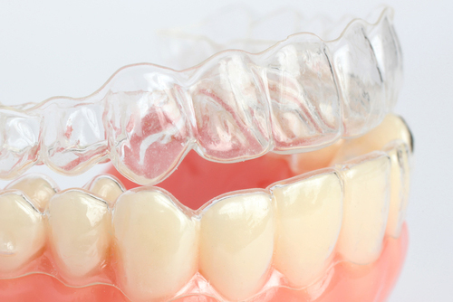 Invisalign Dentist Scarsdale